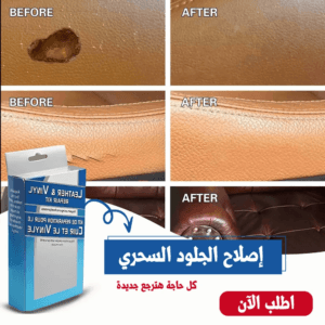 اصلاح الجلود السحرى